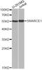 SWI/SNF-related matrix-associated actin-dependent regulator of chromatin subfamily E member 1 antibody, STJ27314, St John