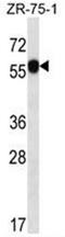 Acidic Residue Methyltransferase 1 antibody, AP50657PU-N, Origene, Western Blot image 