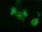 Peroxisomal trans-2-enoyl-CoA reductase antibody, M10430, Boster Biological Technology, Immunofluorescence image 