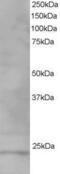 Vacuolar protein sorting-associated protein 28 homolog antibody, GTX10133, GeneTex, Western Blot image 
