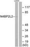 NEDD4 Binding Protein 2 Like 2 antibody, TA315055, Origene, Western Blot image 