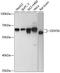 Probable ATP-dependent RNA helicase DDX56 antibody, GTX66571, GeneTex, Western Blot image 