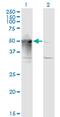Armadillo Repeat Containing 6 antibody, MA5-22880, Invitrogen Antibodies, Western Blot image 