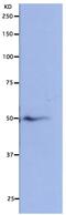 NUF2 Component Of NDC80 Kinetochore Complex antibody, GTX00733, GeneTex, Western Blot image 