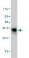 Homeobox protein cut-like 1 antibody, ab54583, Abcam, Western Blot image 