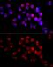 25-hydroxyvitamin D-1 alpha hydroxylase, mitochondrial antibody, GTX00645, GeneTex, Immunocytochemistry image 