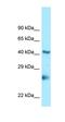 Alpha-1,3-mannosyl-glycoprotein 4-beta-N-acetylglucosaminyltransferase-like protein LOC641515 antibody, orb325453, Biorbyt, Western Blot image 