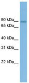 Arf-GAP with GTPase, ANK repeat and PH domain-containing protein 2 antibody, TA340181, Origene, Western Blot image 