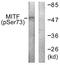 Melanocyte Inducing Transcription Factor antibody, LS-C199259, Lifespan Biosciences, Western Blot image 