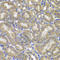 NLR Family CARD Domain Containing 4 antibody, A7382, ABclonal Technology, Immunohistochemistry paraffin image 
