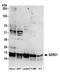 SUZ RNA Binding Domain Containing 1 antibody, A304-742A, Bethyl Labs, Western Blot image 