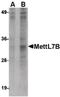 Methyltransferase Like 7B antibody, PA5-20638, Invitrogen Antibodies, Western Blot image 