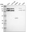 Chloride Voltage-Gated Channel 5 antibody, NBP2-58621, Novus Biologicals, Western Blot image 
