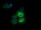Retinoic Acid Receptor Responder 1 antibody, MA5-26248, Invitrogen Antibodies, Immunocytochemistry image 
