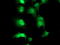 TP53RK Binding Protein antibody, TA800166, Origene, Immunofluorescence image 