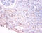 Phosphoglycerate Dehydrogenase antibody, A53941-100, Epigentek, Immunohistochemistry paraffin image 
