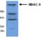 Histone Deacetylase 9 antibody, GTX59653, GeneTex, Western Blot image 