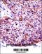 Keratin 6C antibody, 57-552, ProSci, Immunohistochemistry frozen image 