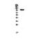 Reversion Inducing Cysteine Rich Protein With Kazal Motifs antibody, A06439-1, Boster Biological Technology, Western Blot image 