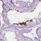 Late Cornified Envelope Like Proline Rich 1 antibody, NBP2-49624, Novus Biologicals, Immunohistochemistry frozen image 