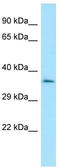 Centromere Protein O antibody, TA331313, Origene, Western Blot image 