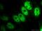 Lysine Demethylase 3A antibody, 12835-1-AP, Proteintech Group, Immunofluorescence image 