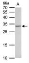 VENT Homeobox antibody, PA5-78478, Invitrogen Antibodies, Western Blot image 
