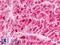 Pumilio homolog 2 antibody, LS-B9123, Lifespan Biosciences, Immunohistochemistry paraffin image 