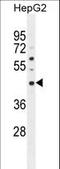 Spermidine/Spermine N1-Acetyl Transferase Like 1 antibody, LS-C162876, Lifespan Biosciences, Western Blot image 
