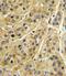MHC Class I Polypeptide-Related Sequence A antibody, PA5-35346, Invitrogen Antibodies, Immunohistochemistry frozen image 