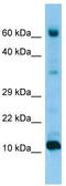 Fatty Acid Binding Protein 9 antibody, TA338319, Origene, Western Blot image 