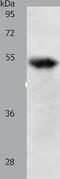 TNF Receptor Superfamily Member 1B antibody, TA321270, Origene, Western Blot image 