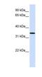 Chromosome 16 Open Reading Frame 78 antibody, NBP1-56418, Novus Biologicals, Western Blot image 