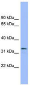 MAF BZIP Transcription Factor B antibody, TA344435, Origene, Western Blot image 