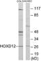 Homeobox D12 antibody, EKC1711, Boster Biological Technology, Western Blot image 