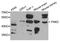 PNKD Metallo-Beta-Lactamase Domain Containing antibody, A04242, Boster Biological Technology, Western Blot image 