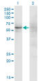 Zinc Finger Protein 180 antibody, LS-C198489, Lifespan Biosciences, Western Blot image 