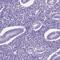 Late Cornified Envelope Like Proline Rich 1 antibody, NBP2-49624, Novus Biologicals, Western Blot image 