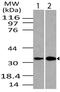 DNA Damage Regulated Autophagy Modulator 1 antibody, A08435, Boster Biological Technology, Western Blot image 