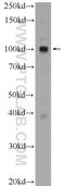 CTAGE Family Member 6 antibody, 17438-1-AP, Proteintech Group, Western Blot image 