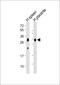 FBP antibody, M04574-1, Boster Biological Technology, Western Blot image 