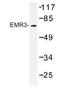 Adhesion G Protein-Coupled Receptor E3 antibody, AP01199PU-N, Origene, Western Blot image 