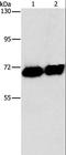 Alkaline Phosphatase, Placental antibody, LS-C404711, Lifespan Biosciences, Western Blot image 