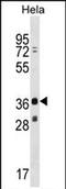 MAGE Family Member B16 antibody, PA5-71981, Invitrogen Antibodies, Western Blot image 