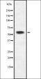 ISL LIM Homeobox 1 antibody, orb335347, Biorbyt, Western Blot image 