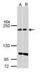 Kinase D Interacting Substrate 220 antibody, LS-B15641, Lifespan Biosciences, Western Blot image 