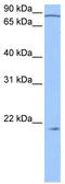 Actin Related Protein 2/3 Complex Subunit 3 antibody, TA340068, Origene, Western Blot image 