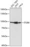 Integrin Subunit Beta 8 antibody, 23-580, ProSci, Western Blot image 