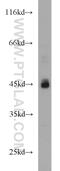 ADA1 antibody, 13328-1-AP, Proteintech Group, Western Blot image 