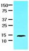 Fatty Acid Binding Protein 1 antibody, ab82157, Abcam, Western Blot image 